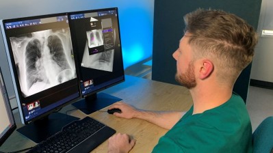 South Tyneside and Sunderland NHS Foundation Trust Consultant Radiologist Peter Hewitt using the AI system to review a patient's x-ray..JPG